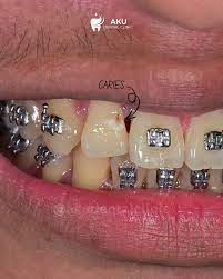 Orthodontics